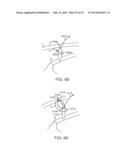 KNOTLESS SUTURE ANCHOR AND METHODS OF USE diagram and image