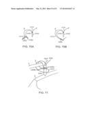 KNOTLESS SUTURE ANCHOR AND METHODS OF USE diagram and image