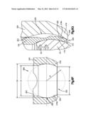 Polyaxial Bone Fixation Element diagram and image