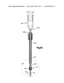 Polyaxial Bone Fixation Element diagram and image