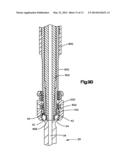 Polyaxial Bone Fixation Element diagram and image