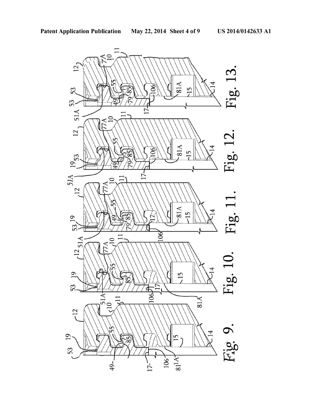 SPLAY CONTROL CLOSURE FOR OPEN BONE ANCHOR - diagram, schematic, and image 05