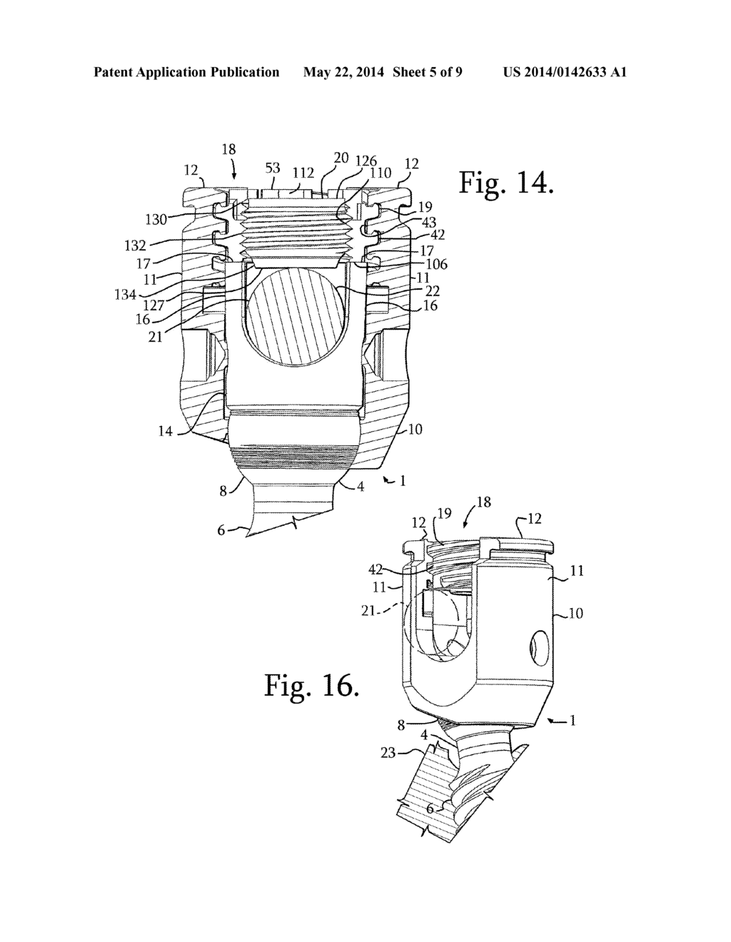 SPLAY CONTROL CLOSURE FOR OPEN BONE ANCHOR - diagram, schematic, and image 06