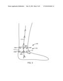 TIBIAL NERVE STIMULATION THERAPY DEVICE CALIBRATION diagram and image