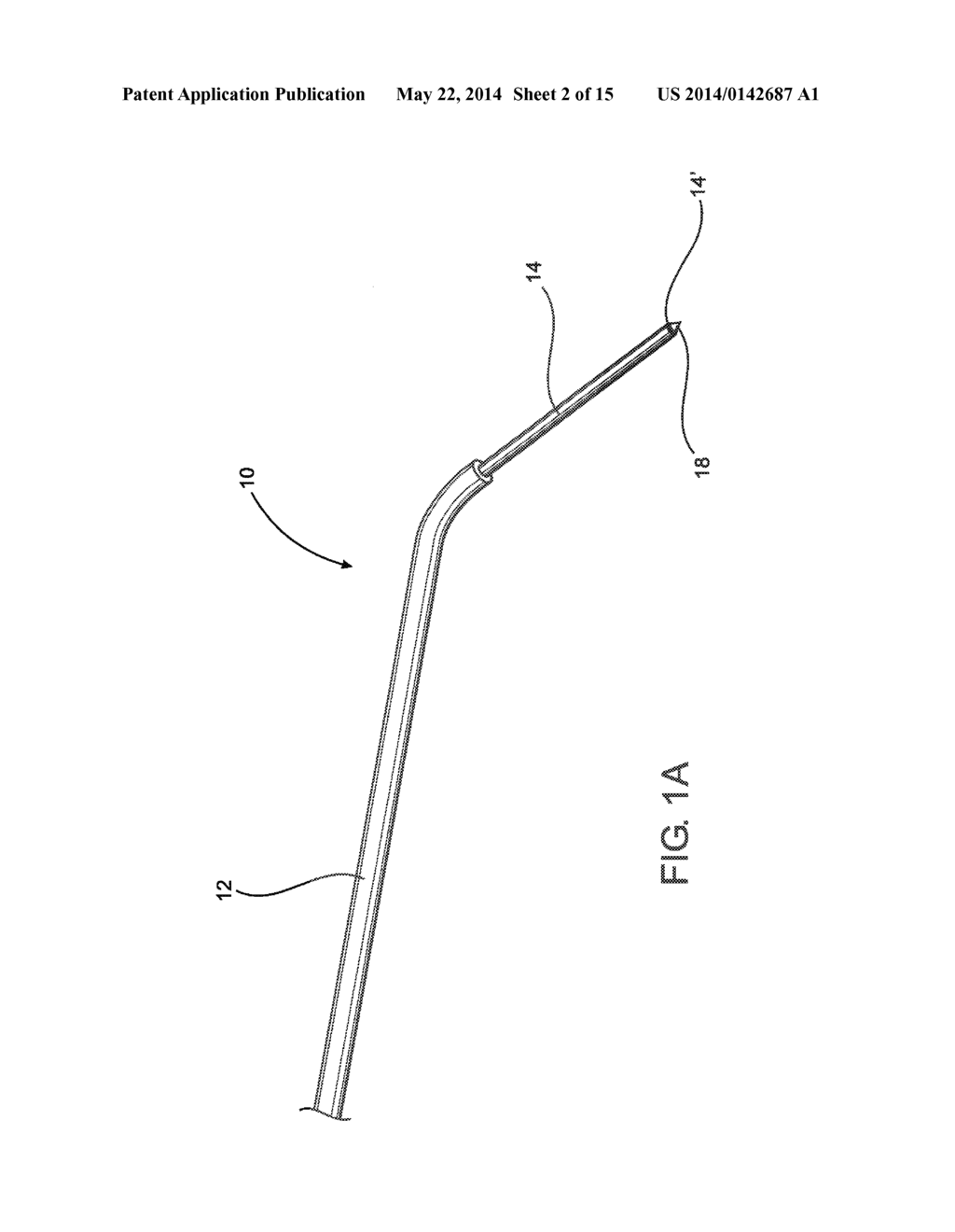 DEVICE AND METHOD OF TREATING HEART VALVE MALFUNCTION - diagram, schematic, and image 03