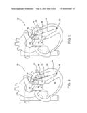 DEVICE AND METHOD OF TREATING HEART VALVE MALFUNCTION diagram and image