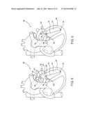 DEVICE AND METHOD OF TREATING HEART VALVE MALFUNCTION diagram and image