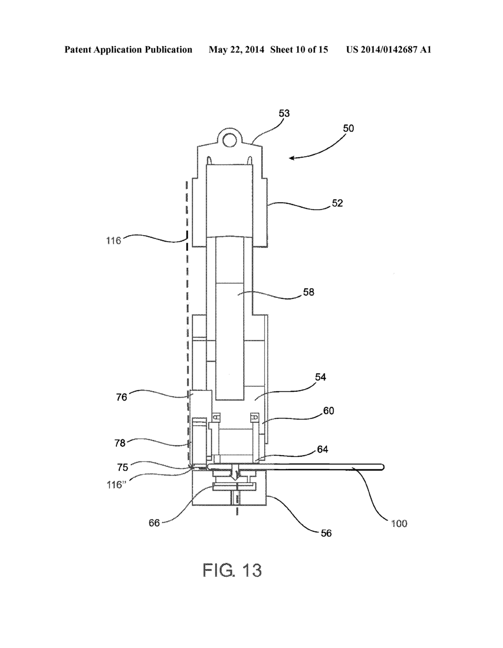 DEVICE AND METHOD OF TREATING HEART VALVE MALFUNCTION - diagram, schematic, and image 11