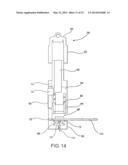 DEVICE AND METHOD OF TREATING HEART VALVE MALFUNCTION diagram and image