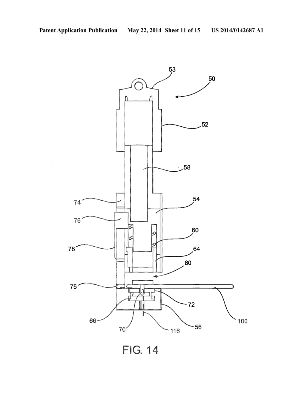 DEVICE AND METHOD OF TREATING HEART VALVE MALFUNCTION - diagram, schematic, and image 12