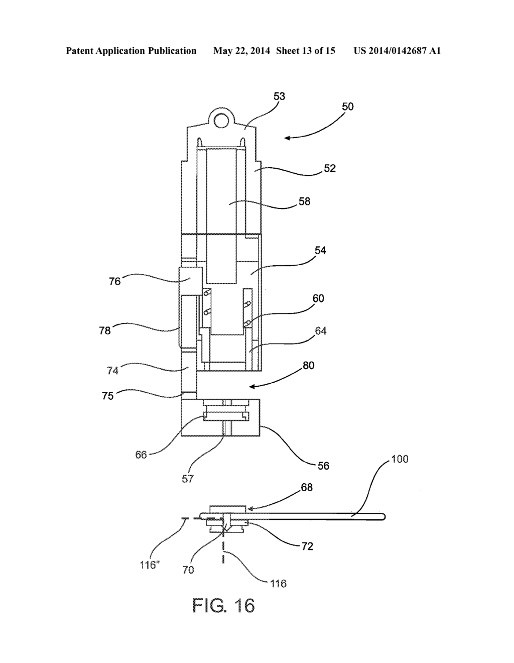 DEVICE AND METHOD OF TREATING HEART VALVE MALFUNCTION - diagram, schematic, and image 14