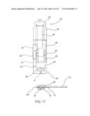 DEVICE AND METHOD OF TREATING HEART VALVE MALFUNCTION diagram and image