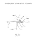 DEVICE AND METHOD OF TREATING HEART VALVE MALFUNCTION diagram and image