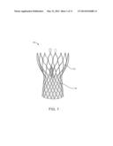 Medical Device Delivery System and Methods of Delivering a Medical Device diagram and image