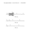 Medical Device Delivery System and Methods of Delivering a Medical Device diagram and image