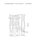 Valve Prosthesis Frames diagram and image