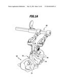 SURGICAL IMPLANT FOR WIDENING A VERTEBRAL CANAL diagram and image