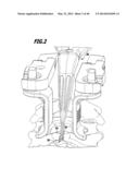 SURGICAL IMPLANT FOR WIDENING A VERTEBRAL CANAL diagram and image