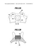 SURGICAL IMPLANT FOR WIDENING A VERTEBRAL CANAL diagram and image
