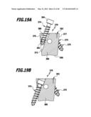 SURGICAL IMPLANT FOR WIDENING A VERTEBRAL CANAL diagram and image