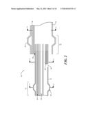 Joint Arthroplasty Devices Formed In Situ diagram and image