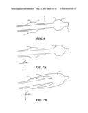 Joint Arthroplasty Devices Formed In Situ diagram and image