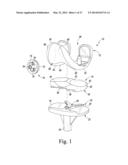 KNEE PROSTHESIS ASSEMBLY HAVING PROPORTIONAL CORONAL GEOMETRY diagram and image