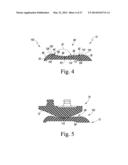 KNEE PROSTHESIS ASSEMBLY HAVING PROPORTIONAL CORONAL GEOMETRY diagram and image