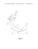 KNEE PROSTHESIS ASSEMBLY HAVING PROPORTIONAL CORONAL GEOMETRY diagram and image