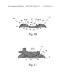 KNEE PROSTHESIS ASSEMBLY HAVING PROPORTIONAL CORONAL GEOMETRY diagram and image