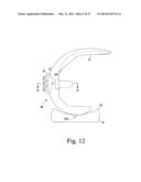 KNEE PROSTHESIS ASSEMBLY HAVING PROPORTIONAL CORONAL GEOMETRY diagram and image