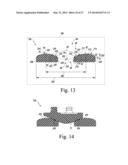 KNEE PROSTHESIS ASSEMBLY HAVING PROPORTIONAL CORONAL GEOMETRY diagram and image