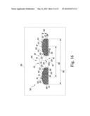 KNEE PROSTHESIS ASSEMBLY HAVING PROPORTIONAL CORONAL GEOMETRY diagram and image