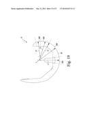 KNEE PROSTHESIS ASSEMBLY HAVING PROPORTIONAL CORONAL GEOMETRY diagram and image