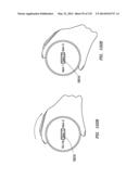 Transition and Interaction Model for Wearable Electronic Device diagram and image