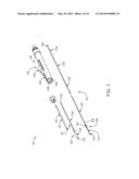 Prosthetic Valve Crimping diagram and image