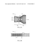 Prosthetic Valve Crimping diagram and image