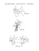 Prosthetic Valve Crimping diagram and image