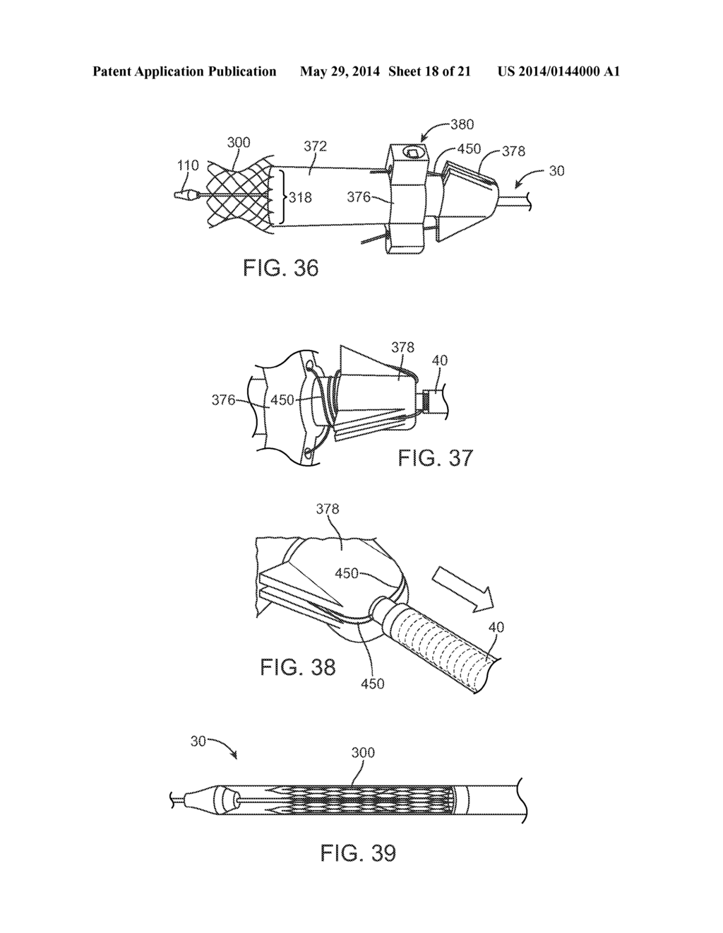 Prosthetic Valve Crimping - diagram, schematic, and image 19