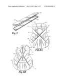 Carbon Fiber Guitar diagram and image