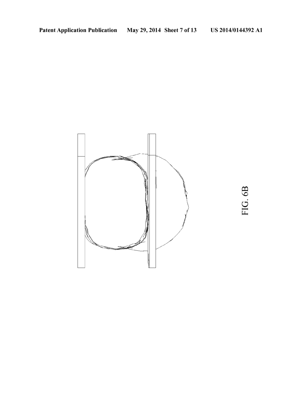 System For Hands-Free Pet Waste Receptacle - diagram, schematic, and image 08