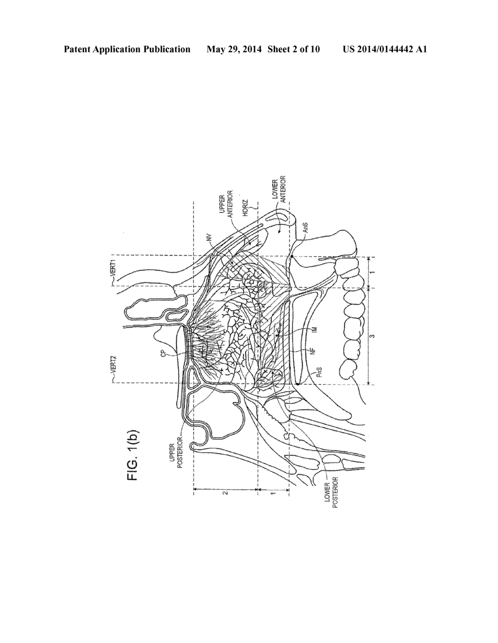 NASAL ADMINISTRATION - diagram, schematic, and image 03