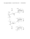 CUSHION FOR PATIENT INTERFACE diagram and image