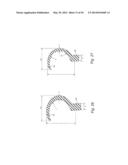 CUSHION FOR PATIENT INTERFACE diagram and image