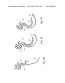 CUSHION FOR PATIENT INTERFACE diagram and image