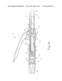 SURGICAL STAPLE WITH INTEGRAL PLEDGET FOR TIP DEFLECTION diagram and image