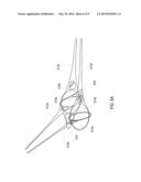 Vertically Integrated Stringers diagram and image