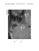 LINE DEPTH AUGMENTATION SYSTEM AND METHOD FOR CONVERSION OF 2D IMAGES TO     3D IMAGES diagram and image