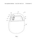 Medical Devices Including Connector Enclosures with an Integrated     Conductor Feed-Through diagram and image