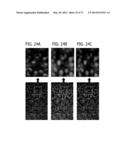 DIRECT ECHO PARTICLE IMAGE VELOCIMETRY FLOW VECTOR MAPPING ON ULTRASOUND     DICOM IMAGES diagram and image